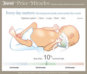 The Providence Journal multimedia: The Price of Miracles - Every day matters
